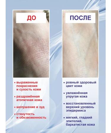 Numis med healthy skin Face cream is a moisturizer for very dry skin 50 ml - Buy Online on GoSupps.com