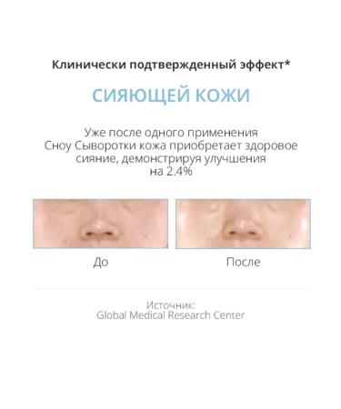 Atomy Snow Anti-Pigmentation Face Serum - Buy Online on GoSupps.com