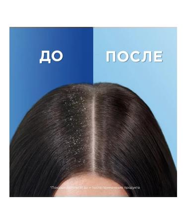 Head&Shoulders Shampoo and balm-drinker for hair 2pcs - Buy Online on GoSupps.com