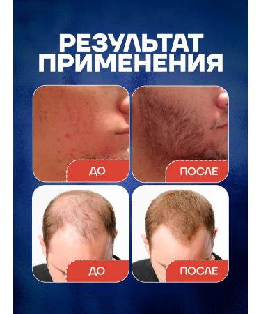 D'umor Hair and beard growth - Buy Online on GoSupps.com