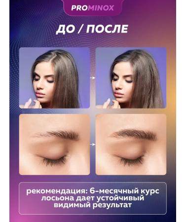 SeruZone Hair and eyebrow growth serum 60 ml 2% - Buy Online on GoSupps.com