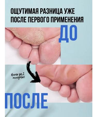 New Keratolytic for heels Professional from corns - Buy Online on GoSupps.com