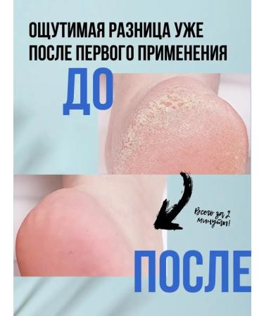 New Keratolytic for heels Professional from corns - Buy Online on GoSupps.com