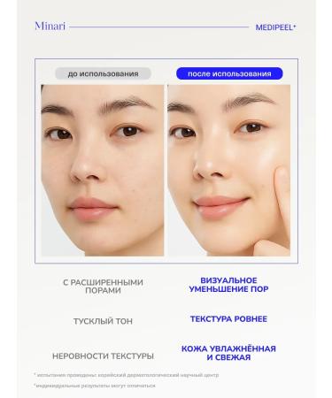 medipeel Mask Fasting Film Pore Extra Super 9 Plus Glow - Buy Online on GoSupps.com