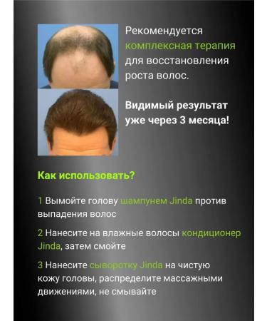 HaiconditionerMax Hair air conditioning from falling out 250 ml - Buy Online on GoSupps.com