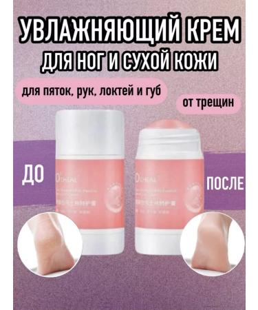 Feet cream from cracks on the feet of the arms of the elbows moisturizing