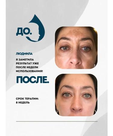 Dr Derma White Whitening - Buy Online on GoSupps.com