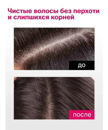 PeelinZone Scalp pyling - set 2 pcs - Buy Online on GoSupps.com