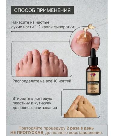 SeruZone Remedy for the nail fungus onholysis 15 ml - Buy Online on GoSupps.com