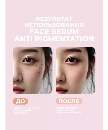 SeruZone Whitening serum for the face from Korea pigmentation - Buy Online on GoSupps.com