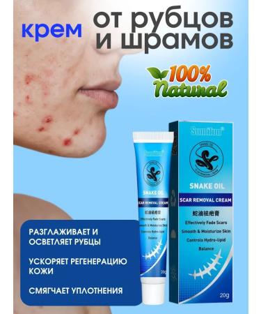 NazPalad Cream from scars of scars from acne with snake oil