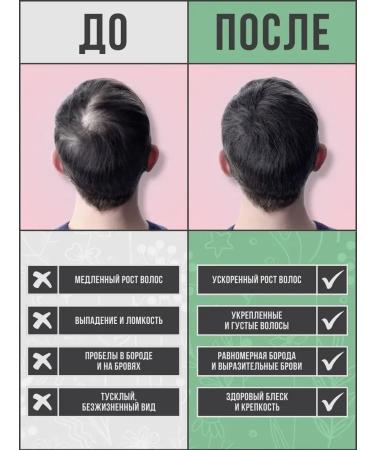 fitomir Eying oil for eyelashes and eyebrows - Buy Online on GoSupps.com