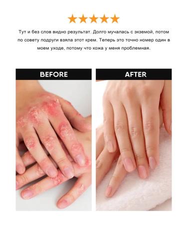 QTiX Cream for dry skin legs and body with urea moisturizing - Buy Online on GoSupps.com