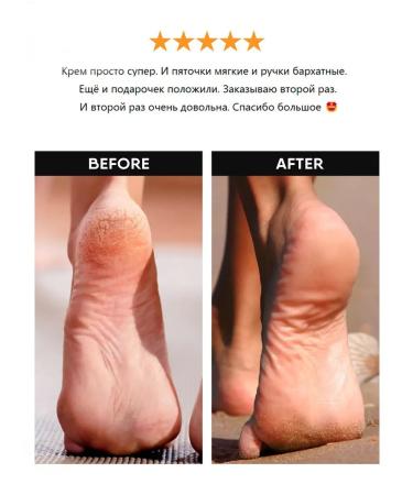 QTiX Cream for dry skin legs and body with urea moisturizing - Buy Online on GoSupps.com