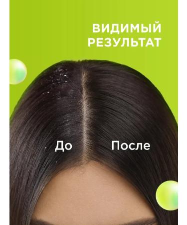 My Muse Shampoo - Balm for hair Professional against dandruff - Buy Online on GoSupps.com