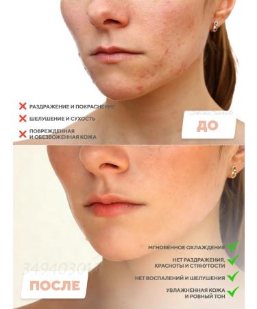 Skin1004 Protective face cream with a centella of 75 ml - Buy Online on GoSupps.com