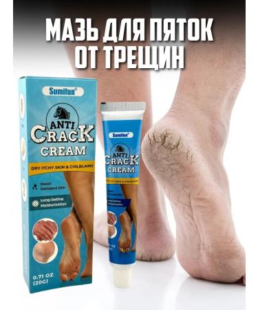 KazBrand Chinese ointment from cracks on heels