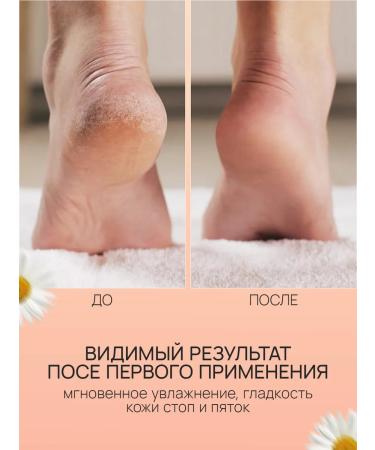 OVAME Foot cream and heels moisturizing a nutritious 100 ml - Buy Online on GoSupps.com