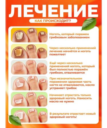 oil from nail fungus 5 ml 5pcs - Buy Online on GoSupps.com