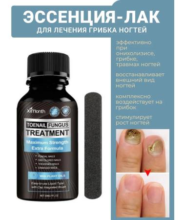 WOW heels Nail fungus agent 30 ml