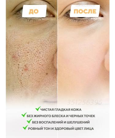 Celimax Toning piling Pads for Facial 60 pieces - Buy Online on GoSupps.com