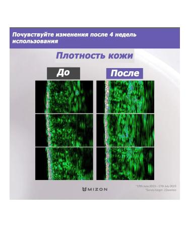 MIZON Le Lift Facial Cream with Collagen and Hyaluron 50ml - Buy Online on GoSupps.com