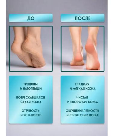 Toe cream with urea - Buy Online on GoSupps.com