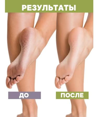 Cream for feet EXTRA-Sensing - Buy Online on GoSupps.com