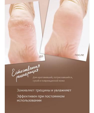 Cream wax from cracks and peeling with panthenol and urea - Buy Online on GoSupps.com