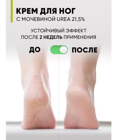 Feet cream from cracks and corns with urea 21.5% 75 ml - Buy Online on GoSupps.com