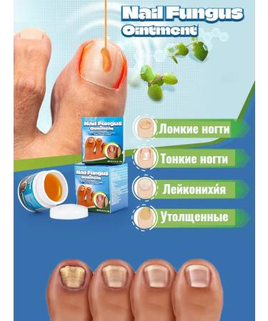 Chinese remedy for nail fungus - Buy Online on GoSupps.com
