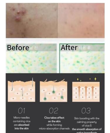 Facial serum with microeles Reedle Shot 300 - Buy Online on GoSupps.com