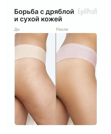 EpilProfi Body cream massage moisturizing nutritious - Buy Online on GoSupps.com