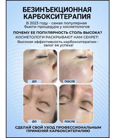 Vishell Face mask carboxytherapy rejuvenating clarifying - Buy Online on GoSupps.com