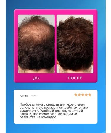 lvcos Hair growth tonic with rosemary - Buy Online on GoSupps.com