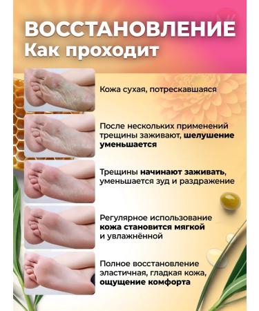 Cream wax from cracks for dry skin and heels - Buy Online on GoSupps.com