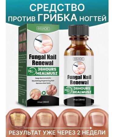 SeruZone Nail fungus remedy
