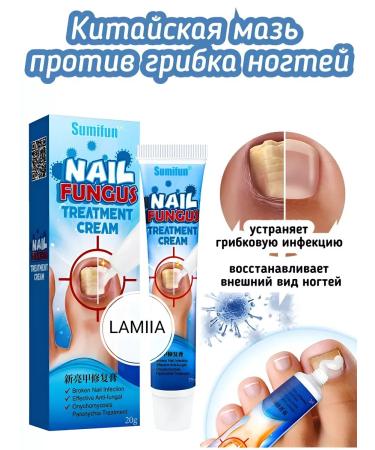 Chinese ointment from nail fungus