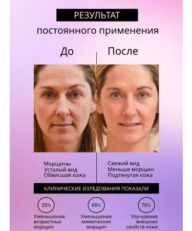 SeruZone Biosol serum for the face of sulfur - Buy Online on GoSupps.com