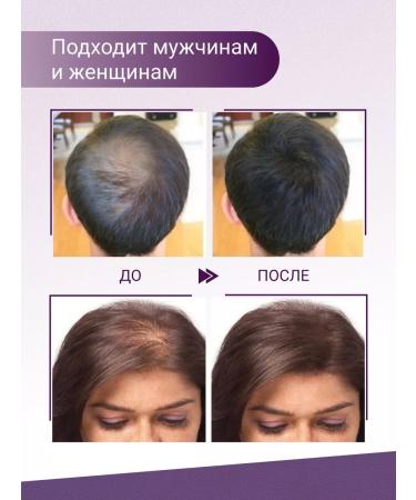 FICHERSTAR Thickener powder camouflage for hair from bald head. Black - Buy Online on GoSupps.com