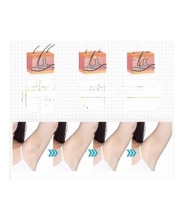 IPL laser epilator for women - Buy Online on GoSupps.com