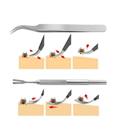 Set for removing ticks Pinzet Kleshhedser - Buy Online on GoSupps.com