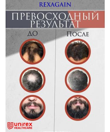 Unirex Healthcare Lotion 16% activator for hair growth and beard - Buy Online on GoSupps.com