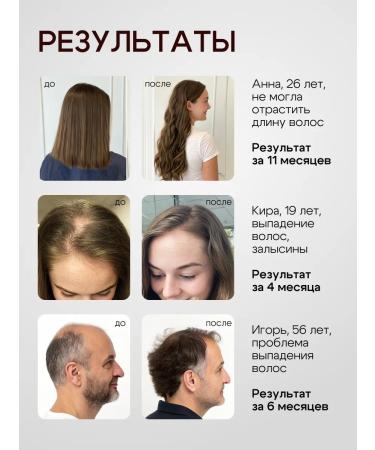 OG Beaute Hair growth with rosemary and niacin - Buy Online on GoSupps.com