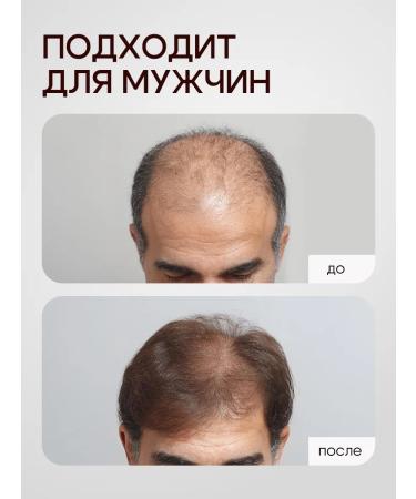 OG Beaute Hair growth with rosemary and niacin - Buy Online on GoSupps.com