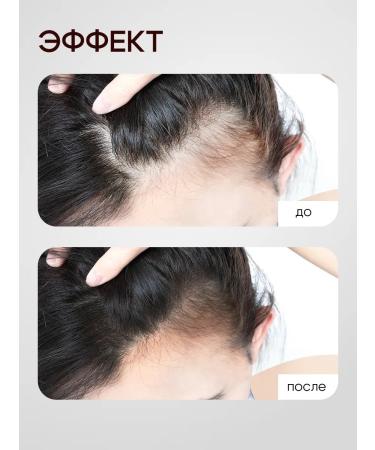 OG Beaute Hair growth with rosemary and niacin - Buy Online on GoSupps.com