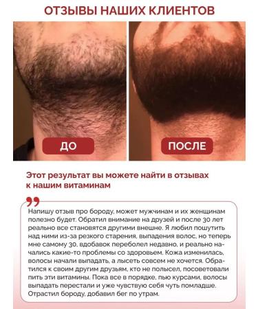 Biotte Collagen+vit.S. 2 cans - Buy Online on GoSupps.com