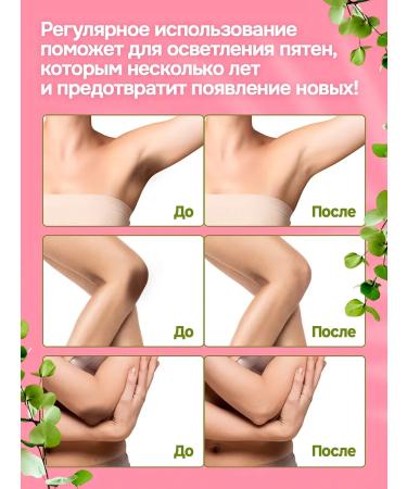 TwinGreen Whitening cream for intimate zones and bodies - Buy Online on GoSupps.com