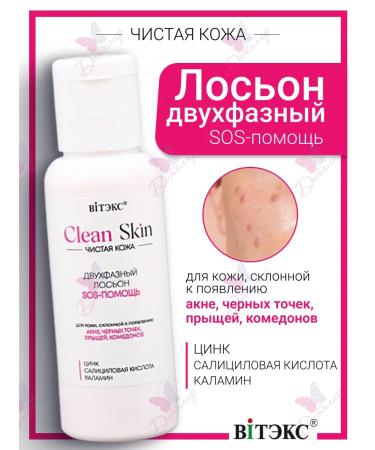 Vitex Two -phase SOS lotion help with zinc salicylic acid