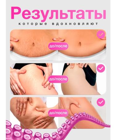 balace sledovnet Cream from stretch marks and scars - Buy Online on GoSupps.com